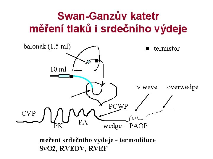 Swan-Ganzův katetr měření tlaků i srdečního výdeje balonek (1. 5 ml) termistor 10 ml