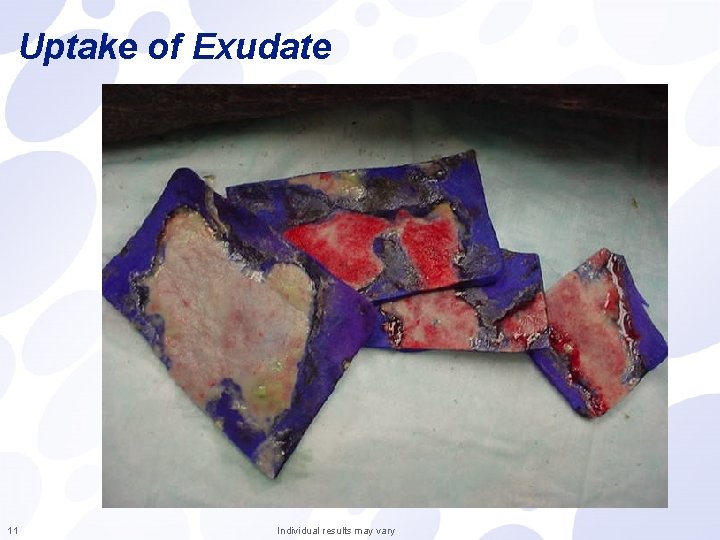 Uptake of Exudate 11 Individual results may vary 