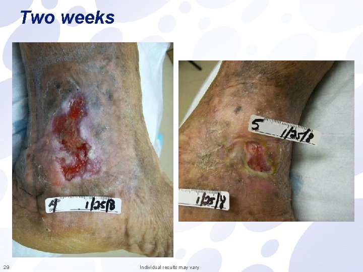 Two weeks 29 Individual results may vary 