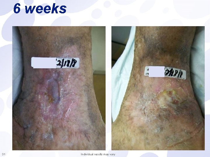 6 weeks 31 Individual results may vary 