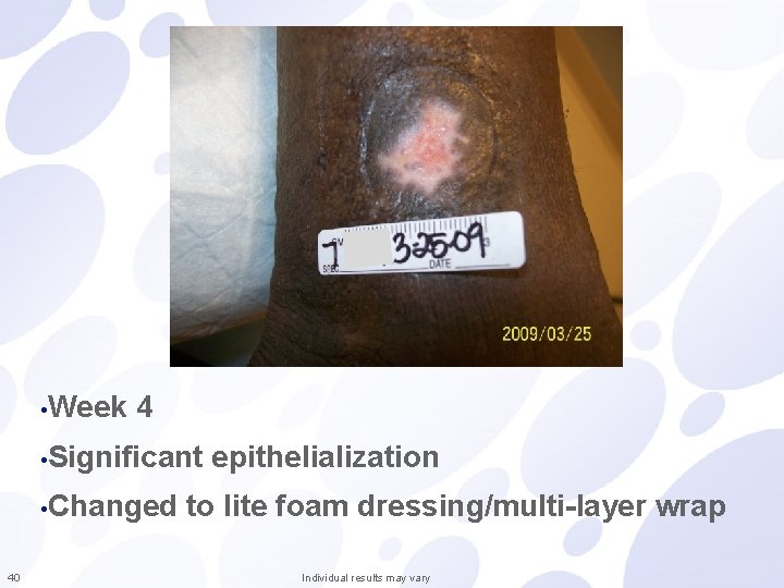  • Week 4 • Significant • Changed 40 epithelialization to lite foam dressing/multi-layer
