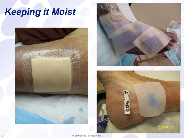 Keeping it Moist 6 Individual results may vary 