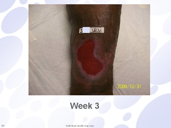 Week 3 63 Individual results may vary 