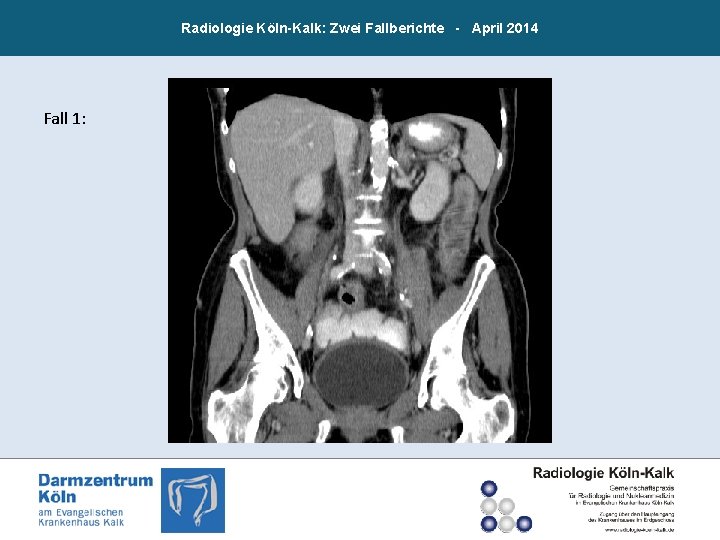 Radiologie Köln-Kalk: Zwei Fallberichte - April 2014 Fall 1: 