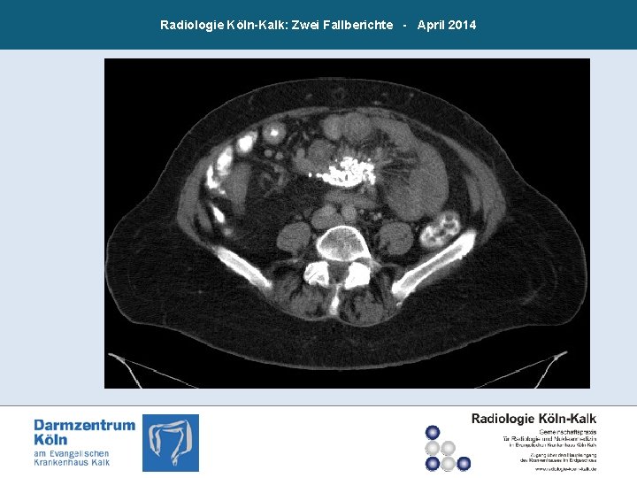 Radiologie Köln-Kalk: Zwei Fallberichte - April 2014 