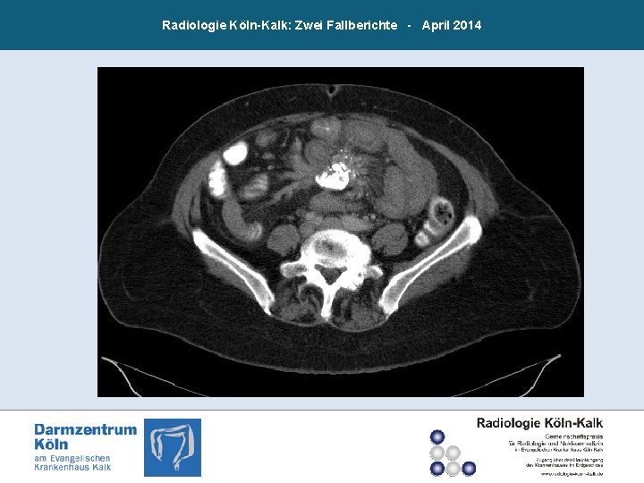 Radiologie Köln-Kalk: Zwei Fallberichte - April 2014 