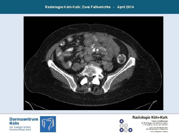 Radiologie Köln-Kalk: Zwei Fallberichte - April 2014 