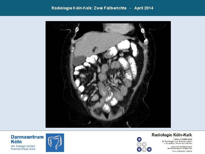 Radiologie Köln-Kalk: Zwei Fallberichte - April 2014 