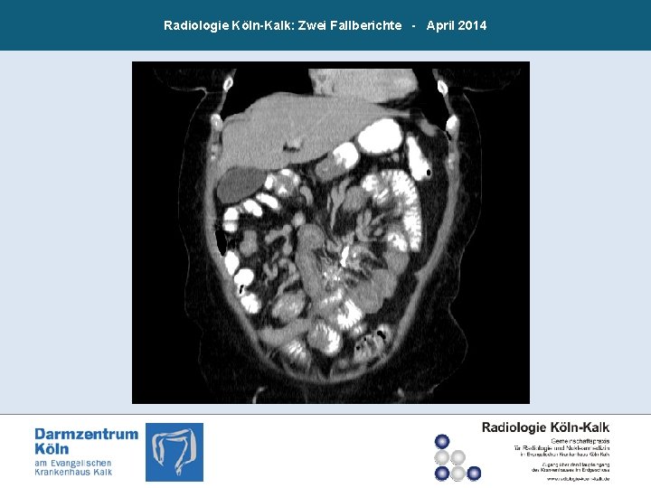 Radiologie Köln-Kalk: Zwei Fallberichte - April 2014 