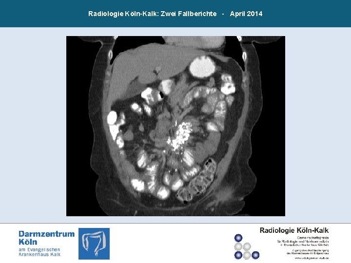 Radiologie Köln-Kalk: Zwei Fallberichte - April 2014 