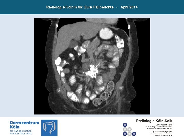 Radiologie Köln-Kalk: Zwei Fallberichte - April 2014 