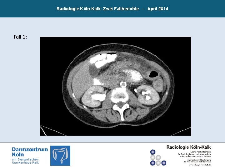 Radiologie Köln-Kalk: Zwei Fallberichte - April 2014 Fall 1: 