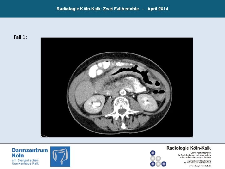 Radiologie Köln-Kalk: Zwei Fallberichte - April 2014 Fall 1: 