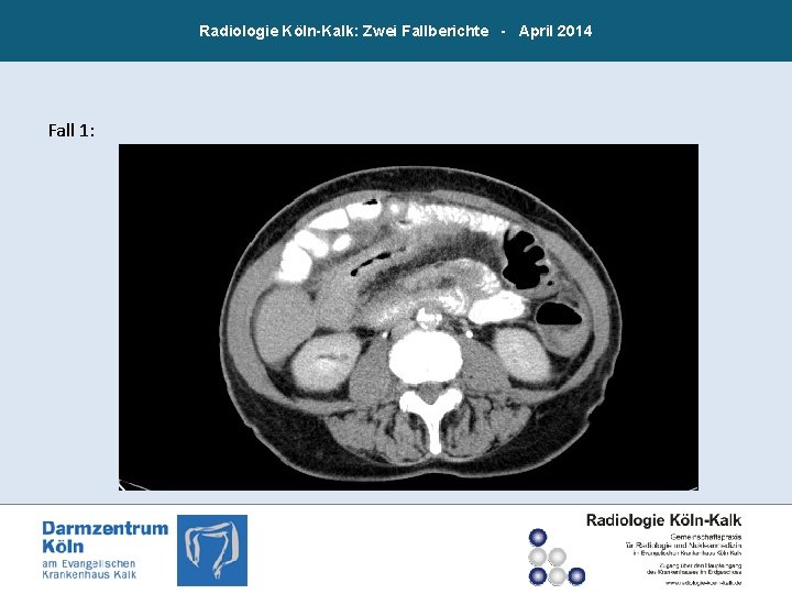 Radiologie Köln-Kalk: Zwei Fallberichte - April 2014 Fall 1: 