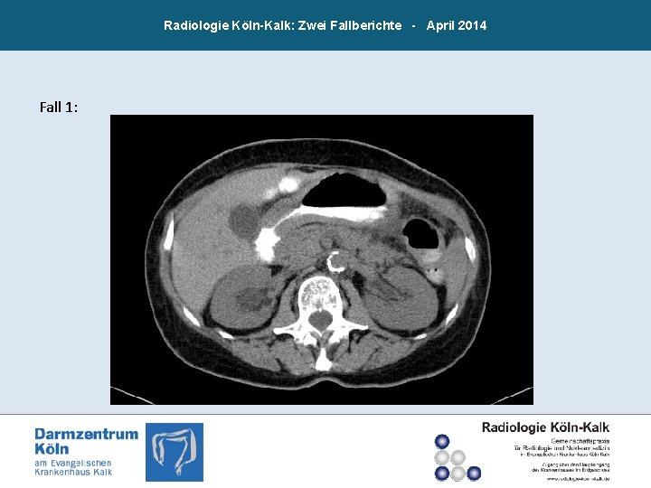 Radiologie Köln-Kalk: Zwei Fallberichte - April 2014 Fall 1: 