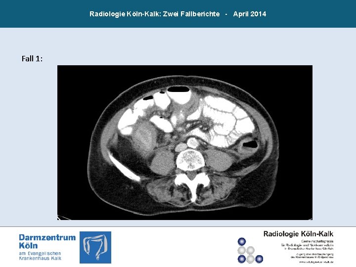 Radiologie Köln-Kalk: Zwei Fallberichte - April 2014 Fall 1: 