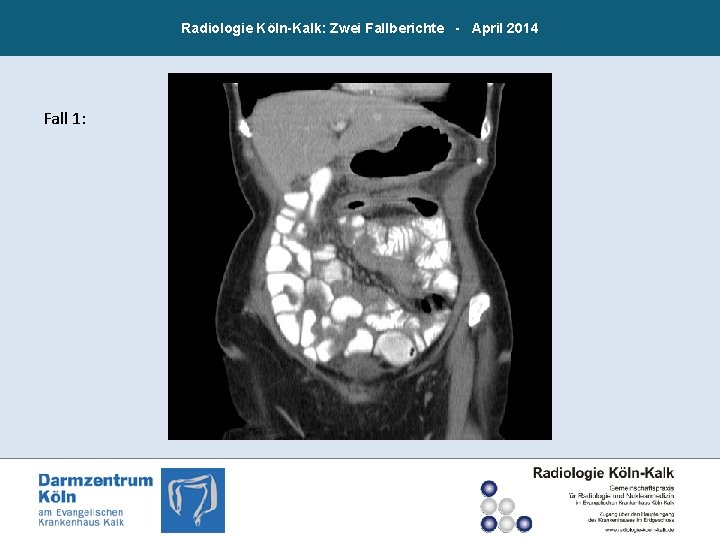 Radiologie Köln-Kalk: Zwei Fallberichte - April 2014 Fall 1: 