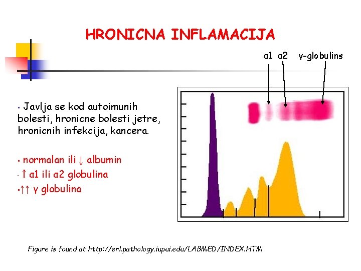 HRONICNA INFLAMACIJA α 1 α 2 Javlja se kod autoimunih bolesti, hronicne bolesti jetre,