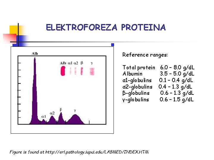 ELEKTROFOREZA PROTEINA n Reference ranges: Total protein Albumin α 1 -globulins α 2 -globulins