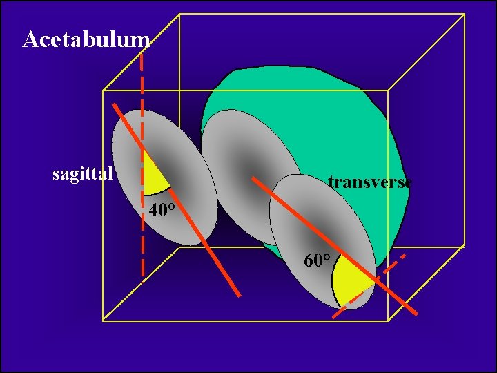 Acetabulum sagittal transverse 40° 60° 