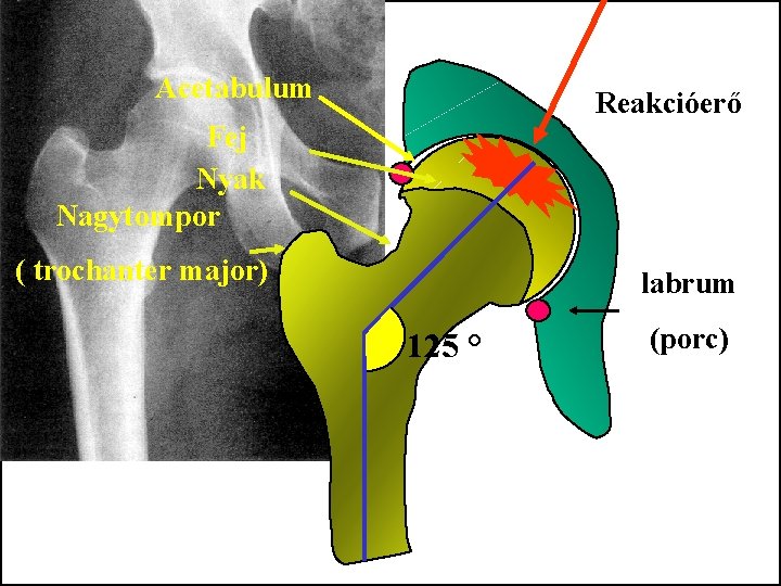 Acetabulum Reakcióerő Fej Nyak Nagytompor ( trochanter major) labrum 125 ° (porc) 