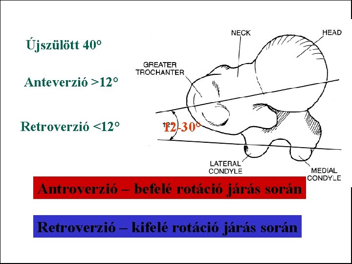 Újszülött 40° Anteverzió >12° Retroverzió <12° 12 -30° Antroverzió – befelé rotáció járás során