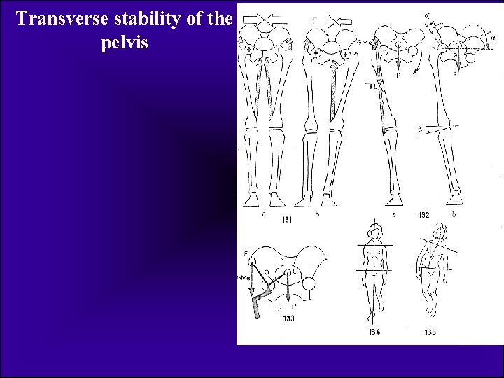 Transverse stability of the pelvis 