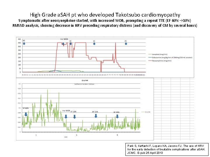 High Grade a. SAH pt who developed Takotsubo cardiomyopathy Symptomatic after neosynephrine started, with