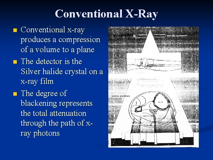 Conventional X-Ray n n n Conventional x-ray produces a compression of a volume to