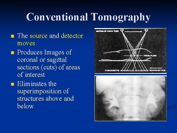 Conventional Tomography n n n The source and detector moves Produces Images of coronal