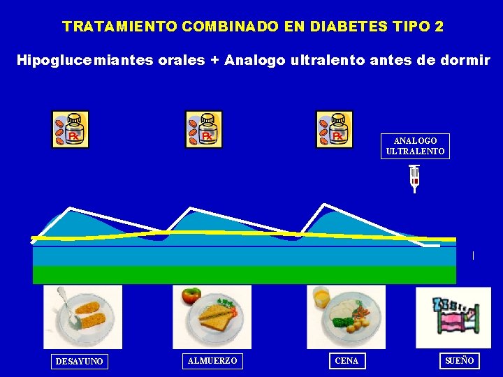 TRATAMIENTO COMBINADO EN DIABETES TIPO 2 Hipoglucemiantes orales + Analogo ultralento antes de dormir