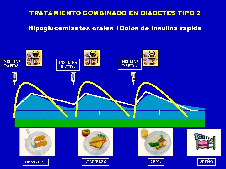 TRATAMIENTO COMBINADO EN DIABETES TIPO 2 Hipoglucemiantes orales +Bolos de insulina rapida INSULINA RAPIDA