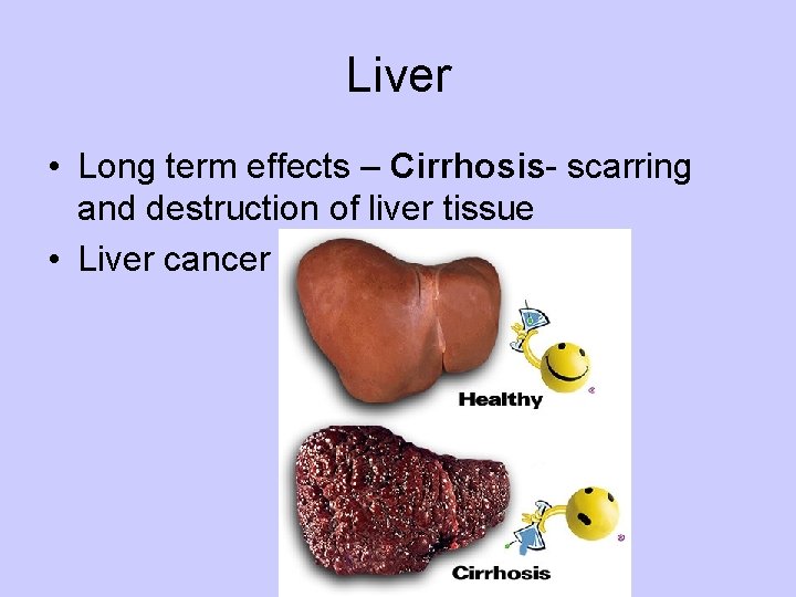 Liver • Long term effects – Cirrhosis- scarring and destruction of liver tissue •