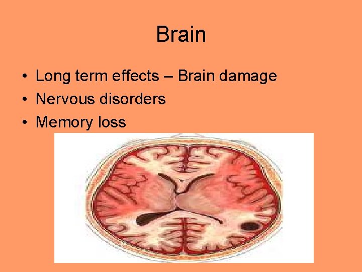 Brain • Long term effects – Brain damage • Nervous disorders • Memory loss