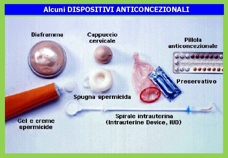 Alcuni DISPOSITIVI ANTICONCEZIONALI 