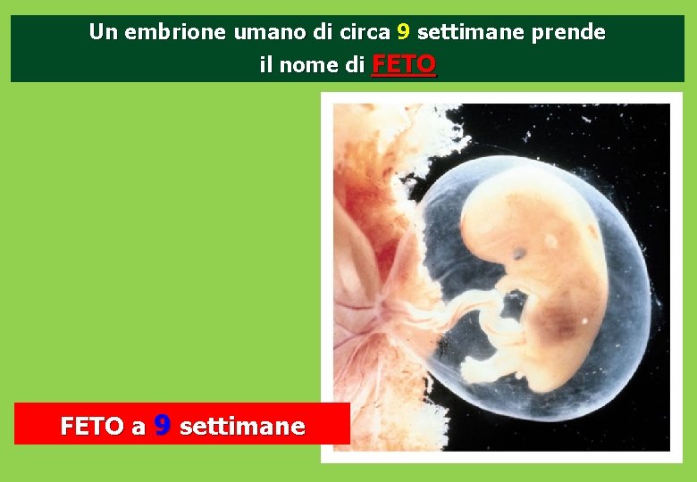 Un embrione umano di circa 9 settimane prende il nome di FETO a 9