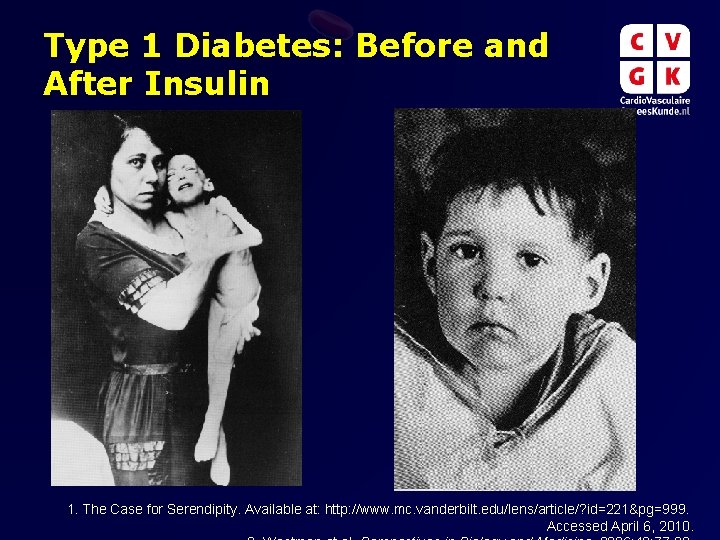 Type 1 Diabetes: Before and After Insulin 1. The Case for Serendipity. Available at: Type 1 Diabetes: Before and After Insulin 1. The Case for Serendipity. Available at: