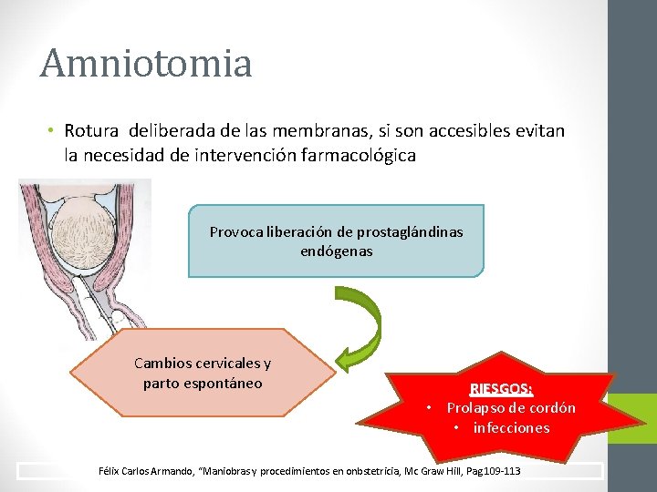 Amniotomia • Rotura deliberada de las membranas, si son accesibles evitan la necesidad de