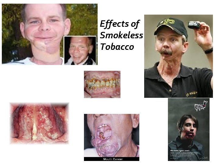 Effects of Smokeless Tobacco 