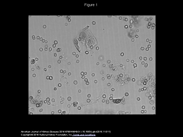 Figure 1 American Journal of Kidney Diseases 2016 67954 -964 DOI: (10. 1053/j. ajkd.