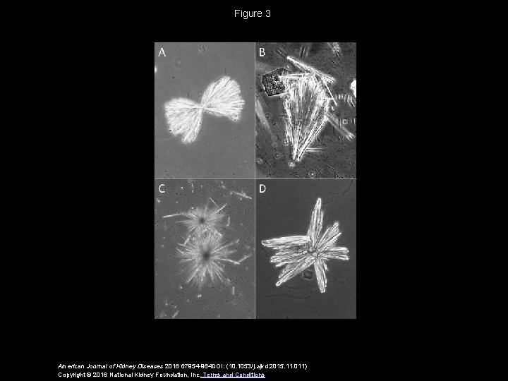 Figure 3 American Journal of Kidney Diseases 2016 67954 -964 DOI: (10. 1053/j. ajkd.