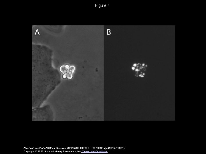 Figure 4 American Journal of Kidney Diseases 2016 67954 -964 DOI: (10. 1053/j. ajkd.