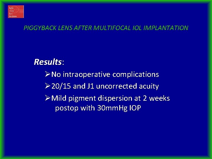 PIGGYBACK LENS AFTER MULTIFOCAL IOL IMPLANTATION Results: ØNo intraoperative complications Ø 20/15 and J