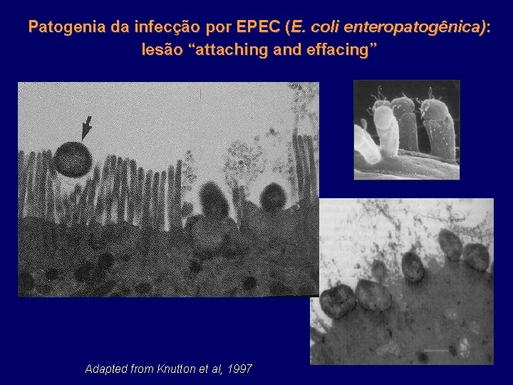 Patogenia da infecção por EPEC (E. coli enteropatogênica): lesão “attaching and effacing” Adapted from