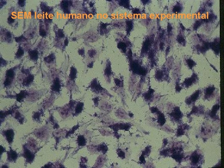 SEM leite humano no sistema experimental 