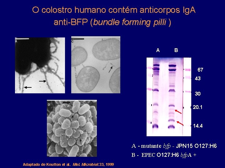 O colostro humano contém anticorpos Ig. A anti-BFP (bundle forming pilli ) A B