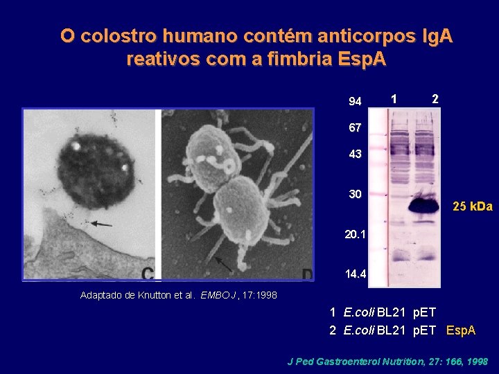 O colostro humano contém anticorpos Ig. A reativos com a fimbria Esp. A 94