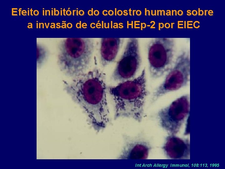 Efeito inibitório do colostro humano sobre a invasão de células HEp-2 por EIEC Int