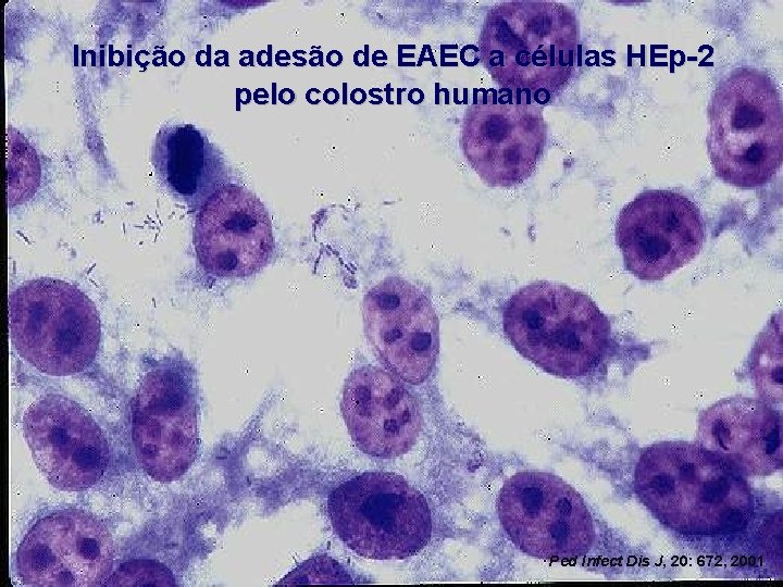 Inibição da adesão de EAEC a células HEp-2 pelo colostro humano Ped Infect Dis