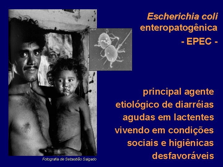 Escherichia coli enteropatogênica - EPEC - Fotografia de Sebastião Salgado principal agente etiológico de